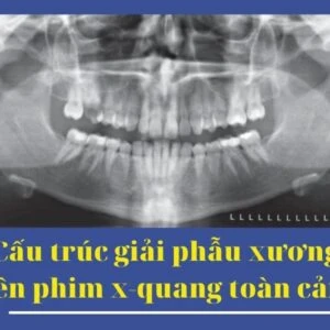 Cấu trúc giải phẫu xương trên phim X-quang toàn cảnh - X quang