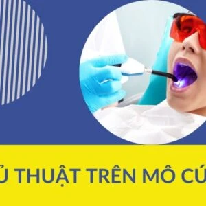 Phẫu thuật trong chỉnh nha (p2) - thủ thuật trên mô cứng - MO CUNG