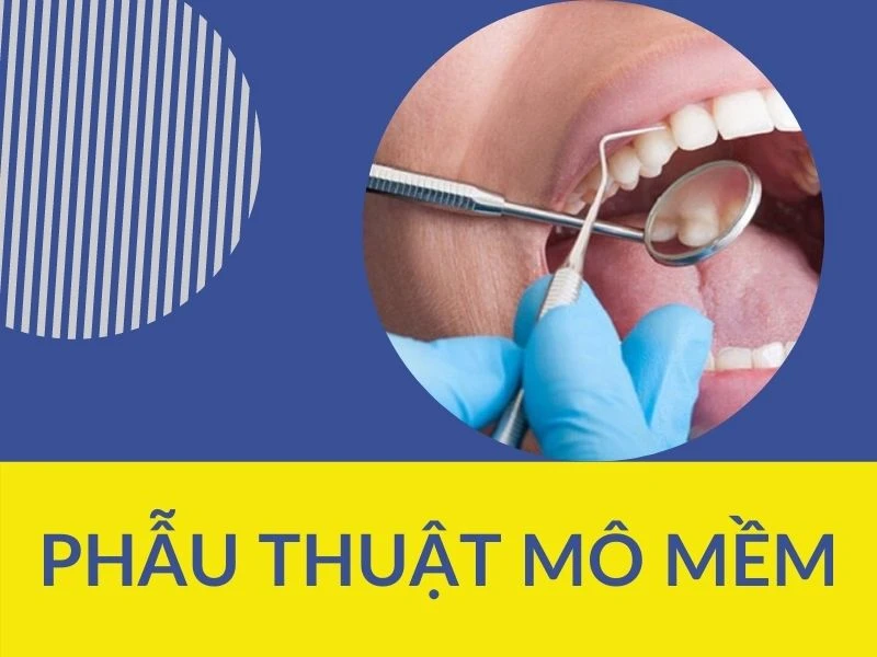 Phẫu thuật trong chỉnh nha (p1) – phẫu thuật mô mềm