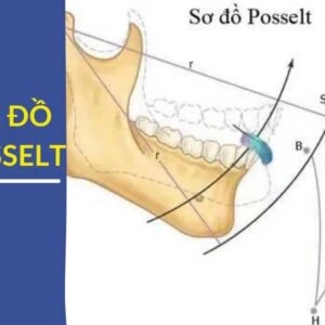 Vận động biên của điểm răng cửa ghi trên mặt phẳng dọc giữa(sơ đồ POSSELT) - So do