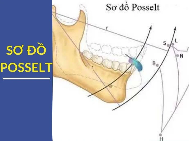Vận động biên của điểm răng cửa ghi trên mặt phẳng dọc giữa(sơ đồ POSSELT)
