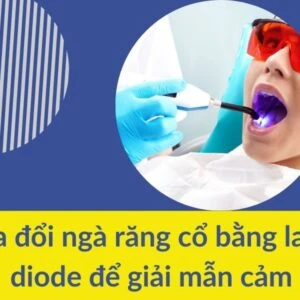 Sửa đổi ngà răng cổ bằng Laser diode để giải mẫn cảm - Sua nga rang