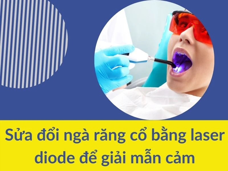 Sửa đổi ngà răng cổ bằng Laser diode để giải mẫn cảm