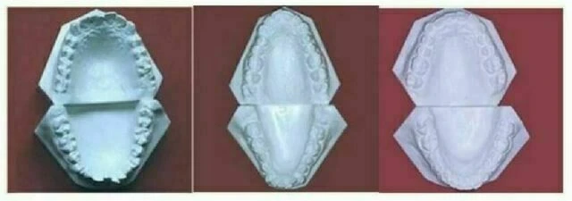 Hình thể cung răng