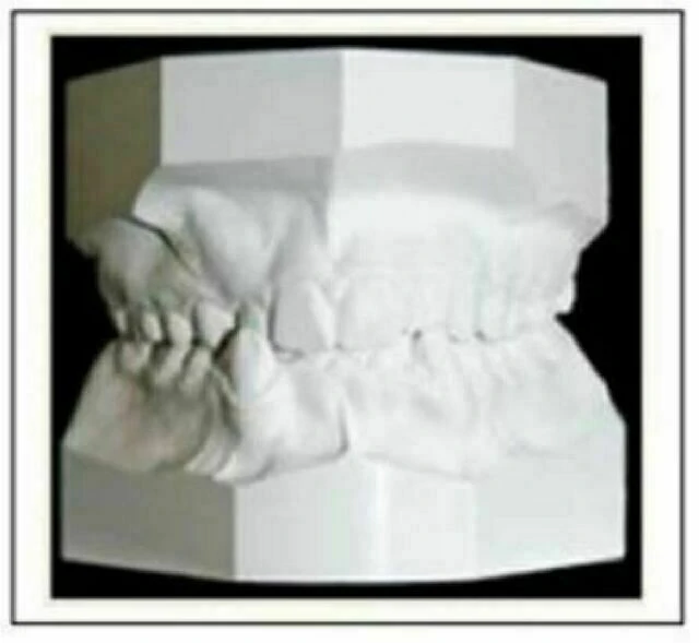 tự học chỉnh nha mẫu hàm