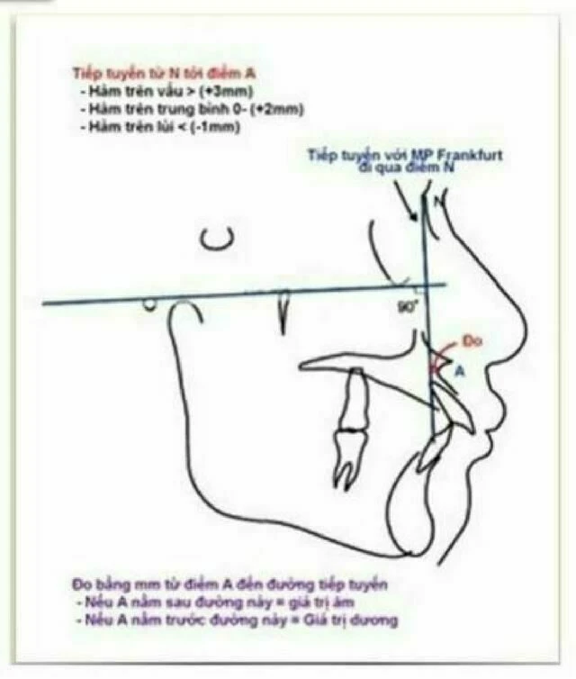 Tiếp tuyến qua N tới A