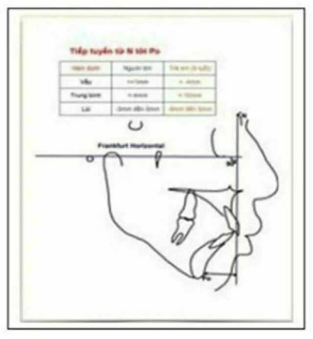 phim sọ nghiêng - Tiếp tuyến qua N tới Po