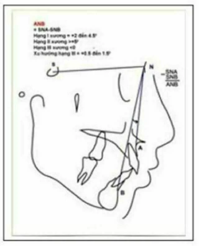 phim sọ nghiêng - Tiếp tuyến qua N tới Po