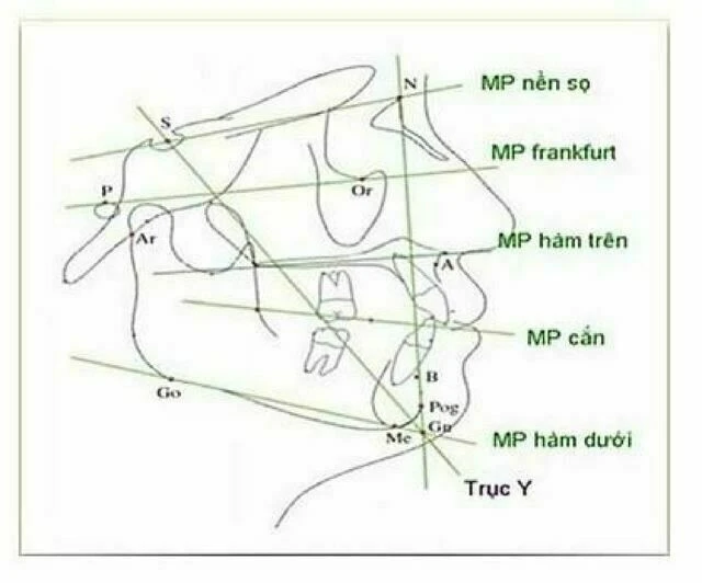 Các mặt phẳng sử dụng trong phân tích phim sọ nghiêng