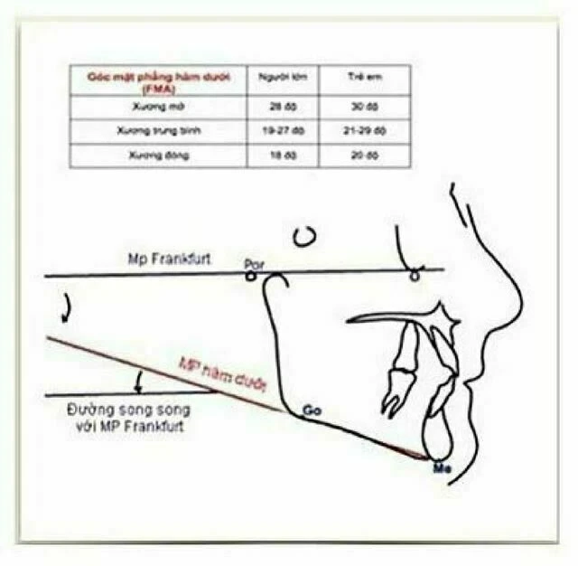 Góc mặt phẳng hàm dưới (FMA)