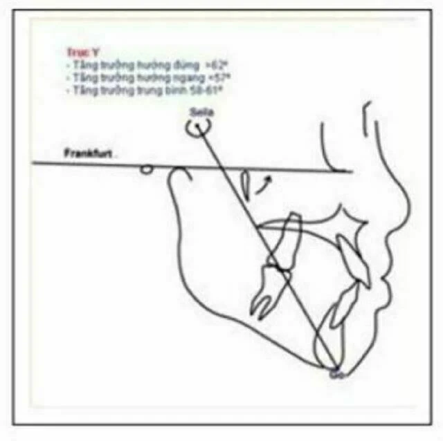 phim sọ nghiêng - Trục Y