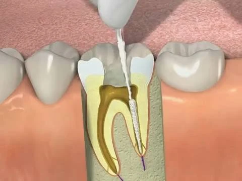 Sinh học tủy răng trong nha khoa phục hồi