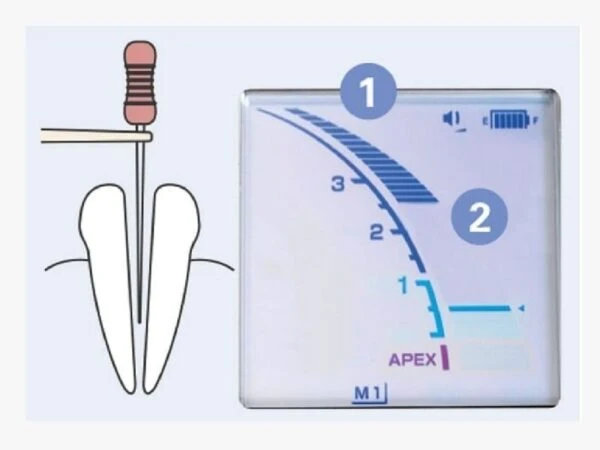 Dinh-vi-chop-Morita-Nhat-Ban