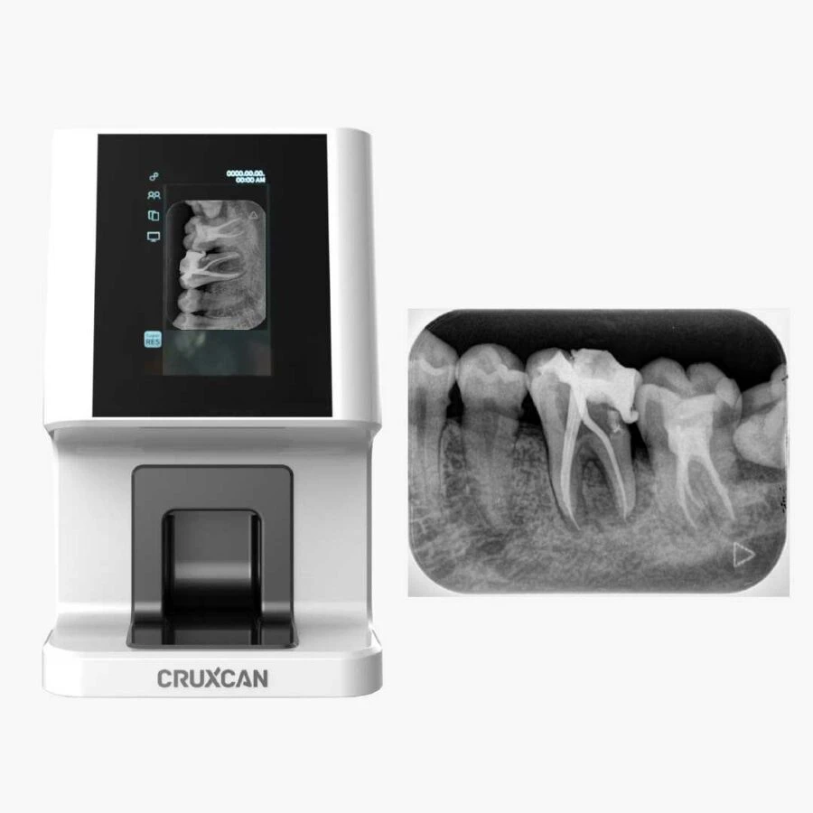 hình ảnh chụp xquang cận chóp