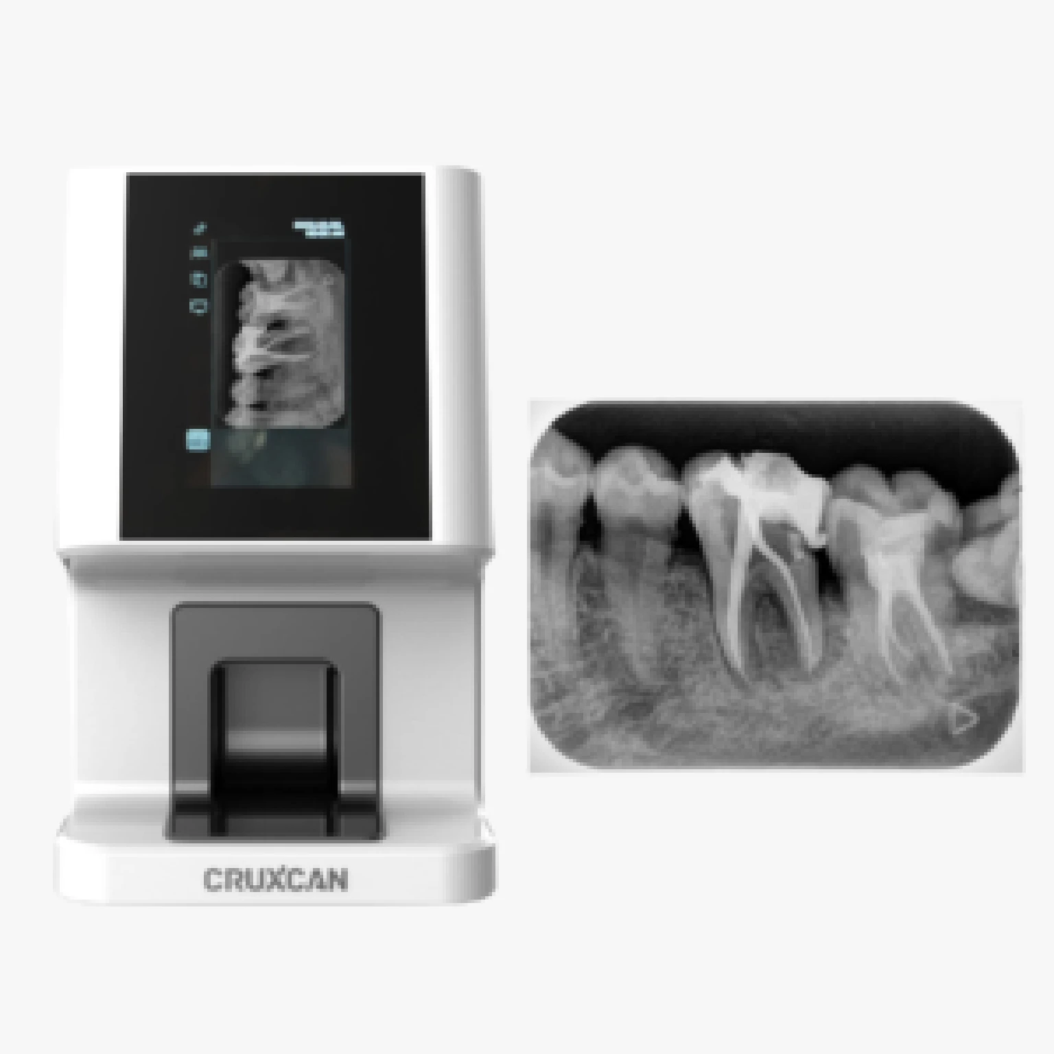 Máy scan phim nha khoa, máy quét phim nha khoa
