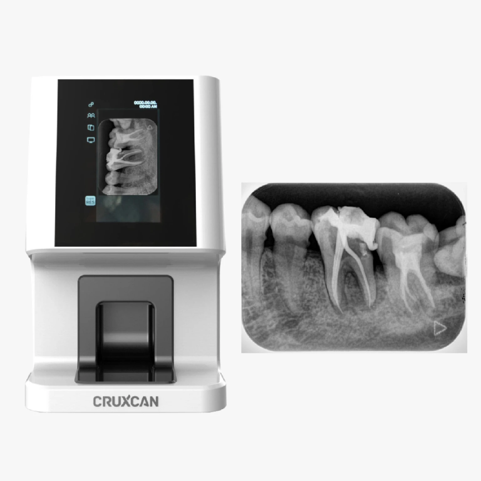 Máy quét phim nha khoa Cruxell 1000