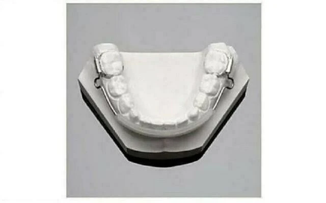 chỉnh nha không nhổ răng - Lip Bumper
