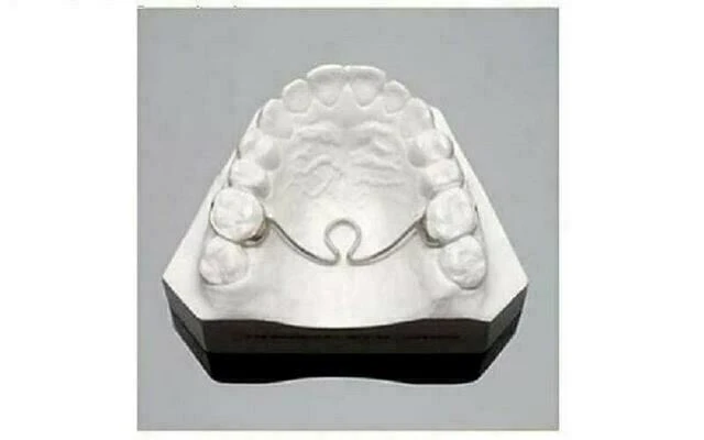 Thanh ngang khẩu (TPA)