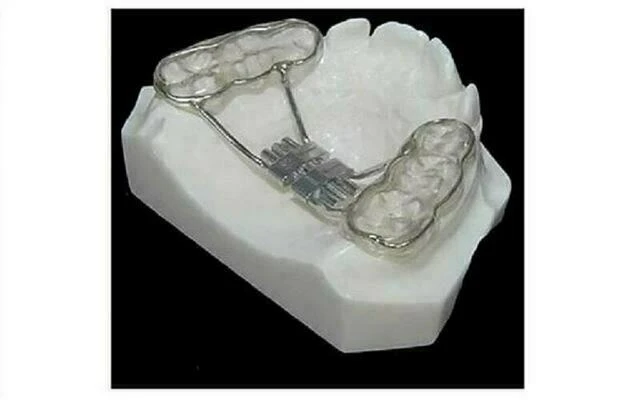 Rapid Palatal Expander(RPE)