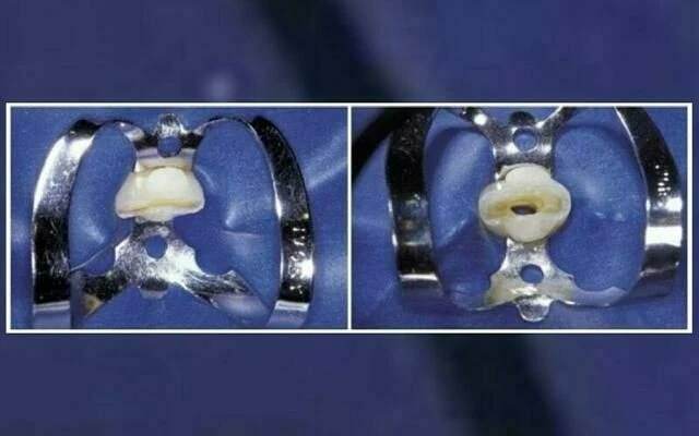 giải phẫu xoang tủy