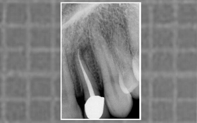 phim sau điều trị