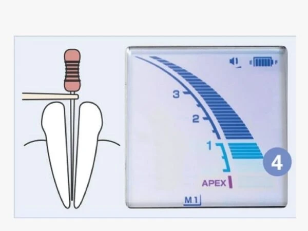 Dinh-vi-chop-Morita-Nhat-Ban