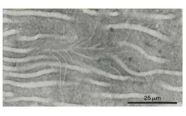 Các ống ngà nhỏ và siêu nhỏ có thể thấy được ở phần chóp chân răng