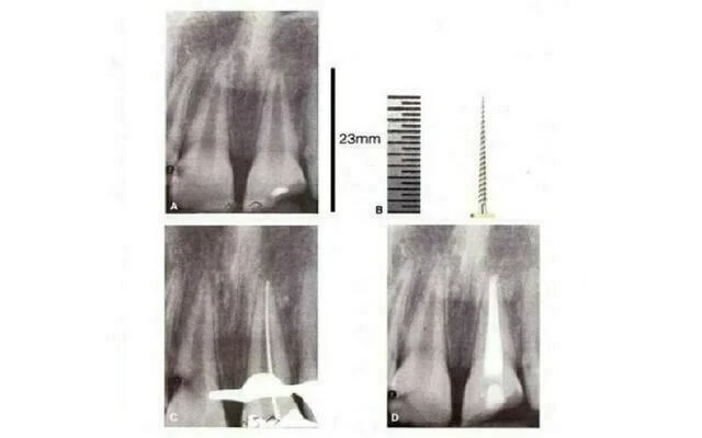 XÁC ĐỊNH CHIỀU DÀI LÀM VIỆC - kỹ thuật Xquang