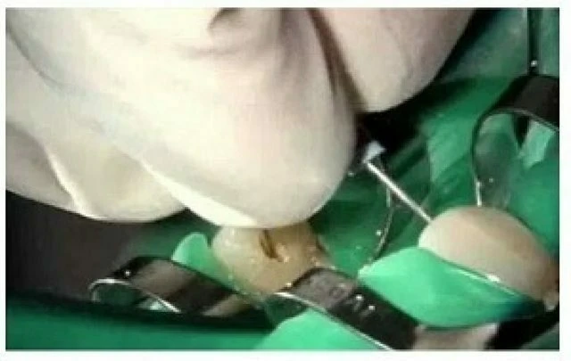 Phương pháp sử dụng cảm giác tay