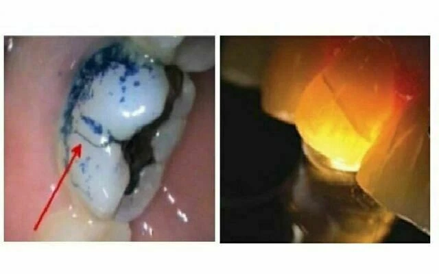 thử nghiệm tủy - PHƯƠNG PHÁP NHUỘM MÀU VÀ PHƯƠNG PHÁP CHIẾU ĐÈN