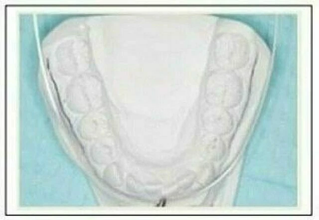 tự học chỉnh nha