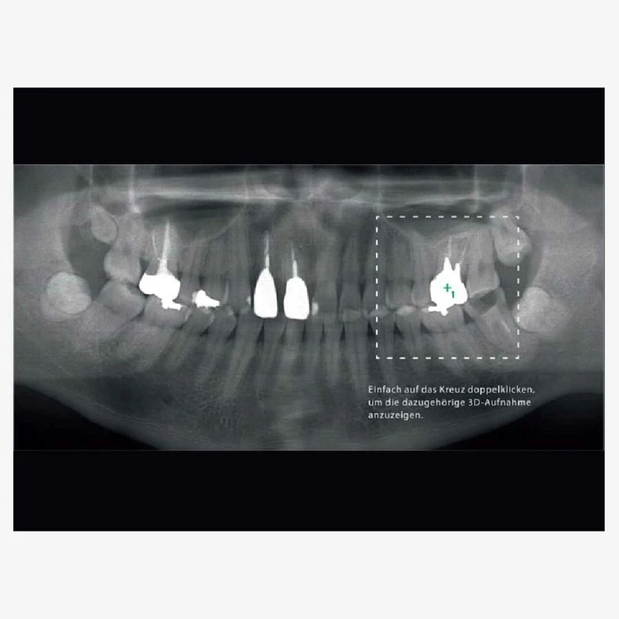 xquang-veraviewepocs-3D-R100-F40-09