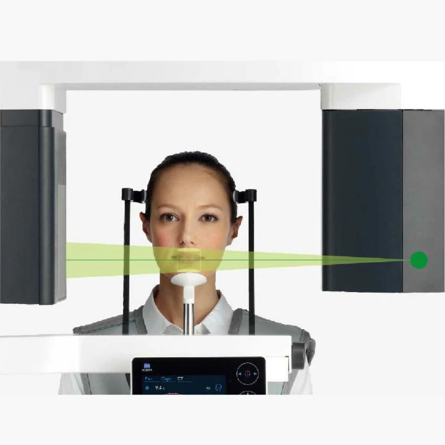 Chức năng FOV quanh răng