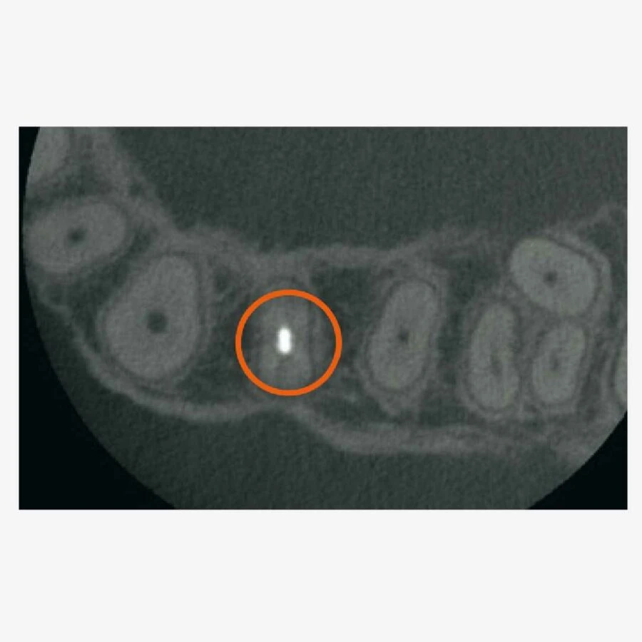 phát hiện dù nhỏ nhất