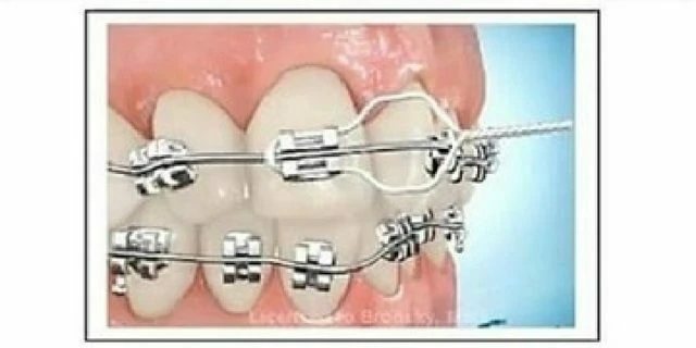 tự học chỉnh nha