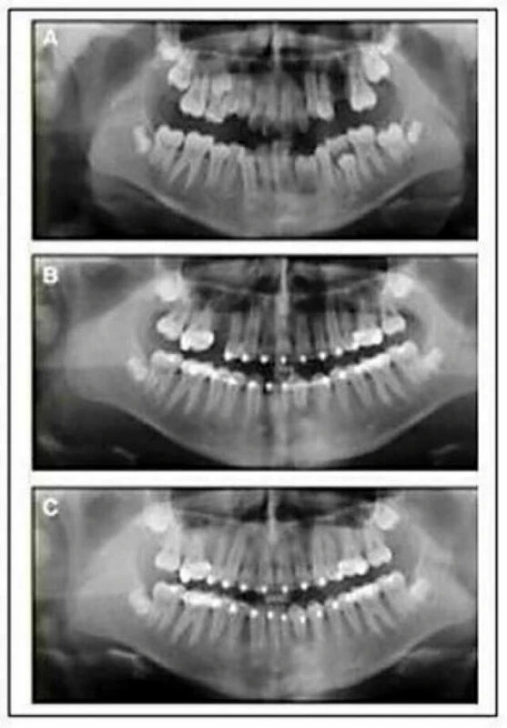 tự học chỉnh nha