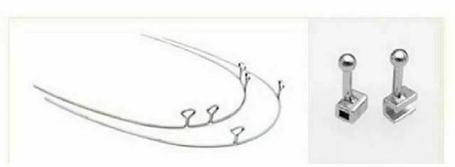 tự học chỉnh nha