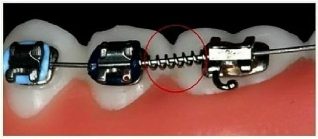 tự học chỉnh nha