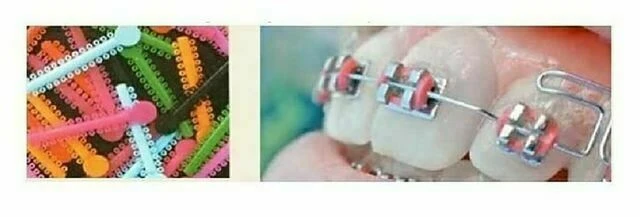 tự học chỉnh nha