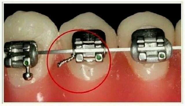 tự học chỉnh nha