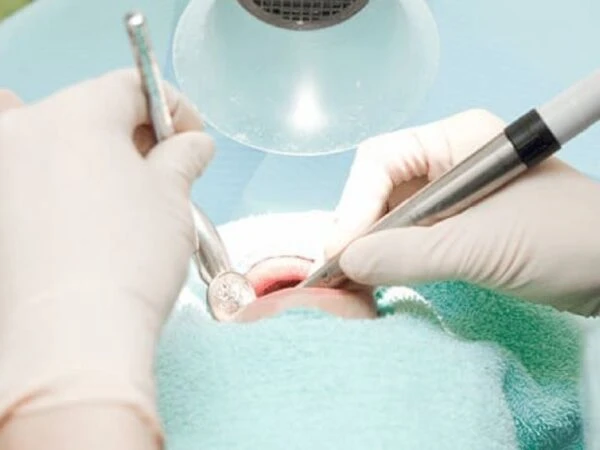 May-hut-vo-khuan-Free-Arm-Forte