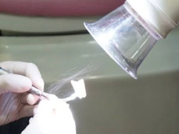 May-hut-vo-khuan-Free-Arm-Forte