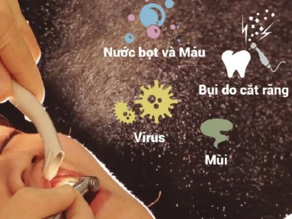 May-hut-vo-khuan-Free-Arm-Forte