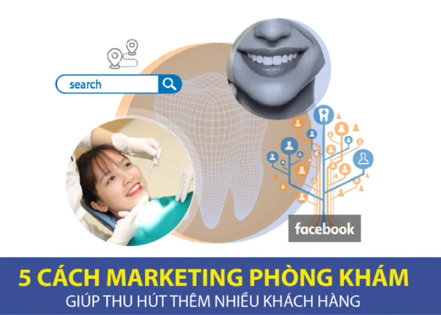 marketing-nha-khoa