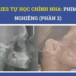 Series tự học chỉnh nha: phim sọ nghiêng (phần 1) - 12