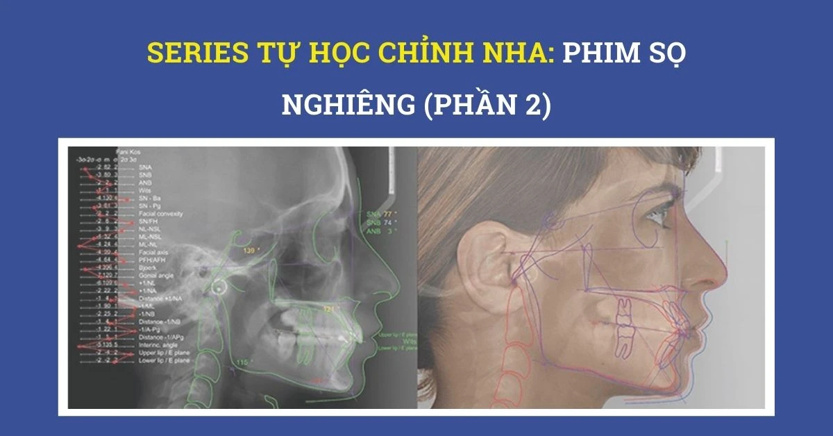 Series tự học chỉnh nha: phim sọ nghiêng (phần 1)