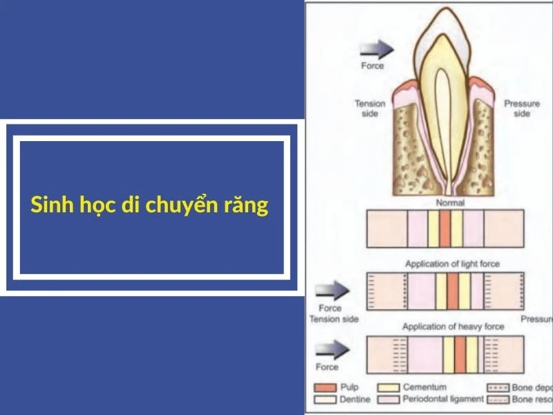 Sinh học di chuyển răng – cơ chế