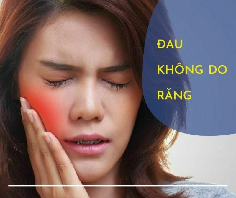 Đau không do răng