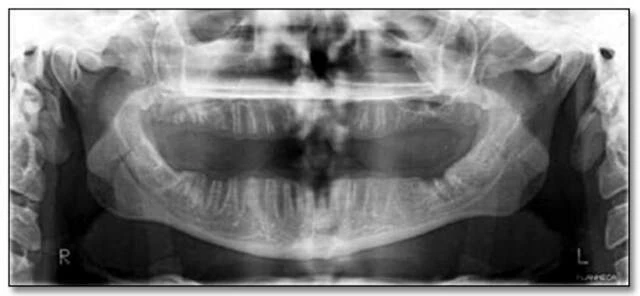 xquang toan canh panorama