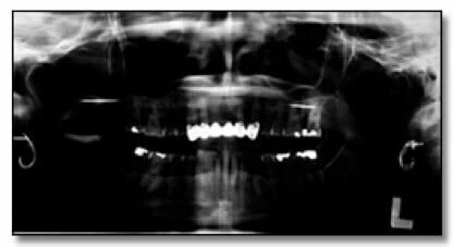 xquang toan canh panorama